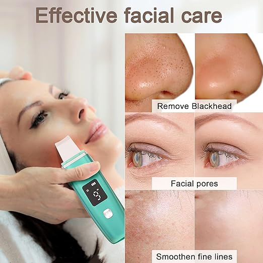 Ultrasonic Blackhead Remover Scrubber