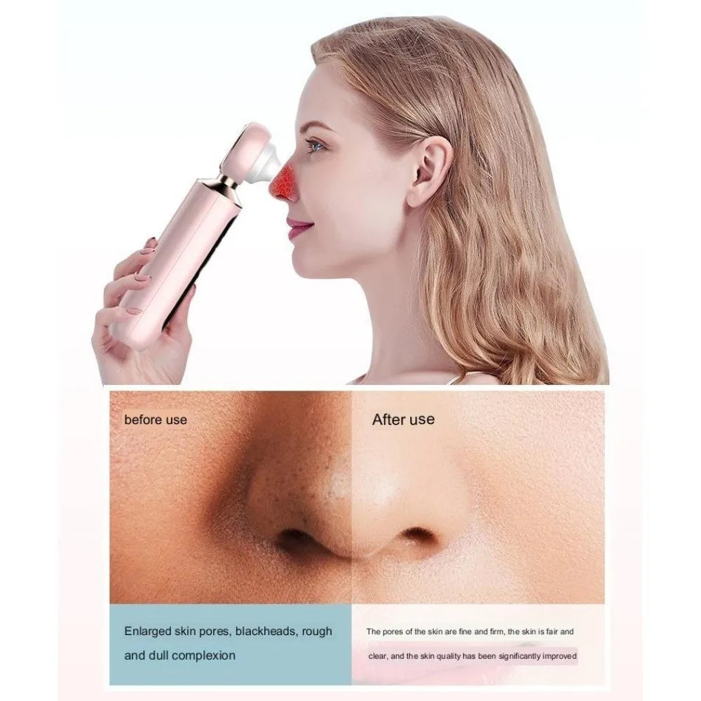 Visual Blackhead Pore Cleaner