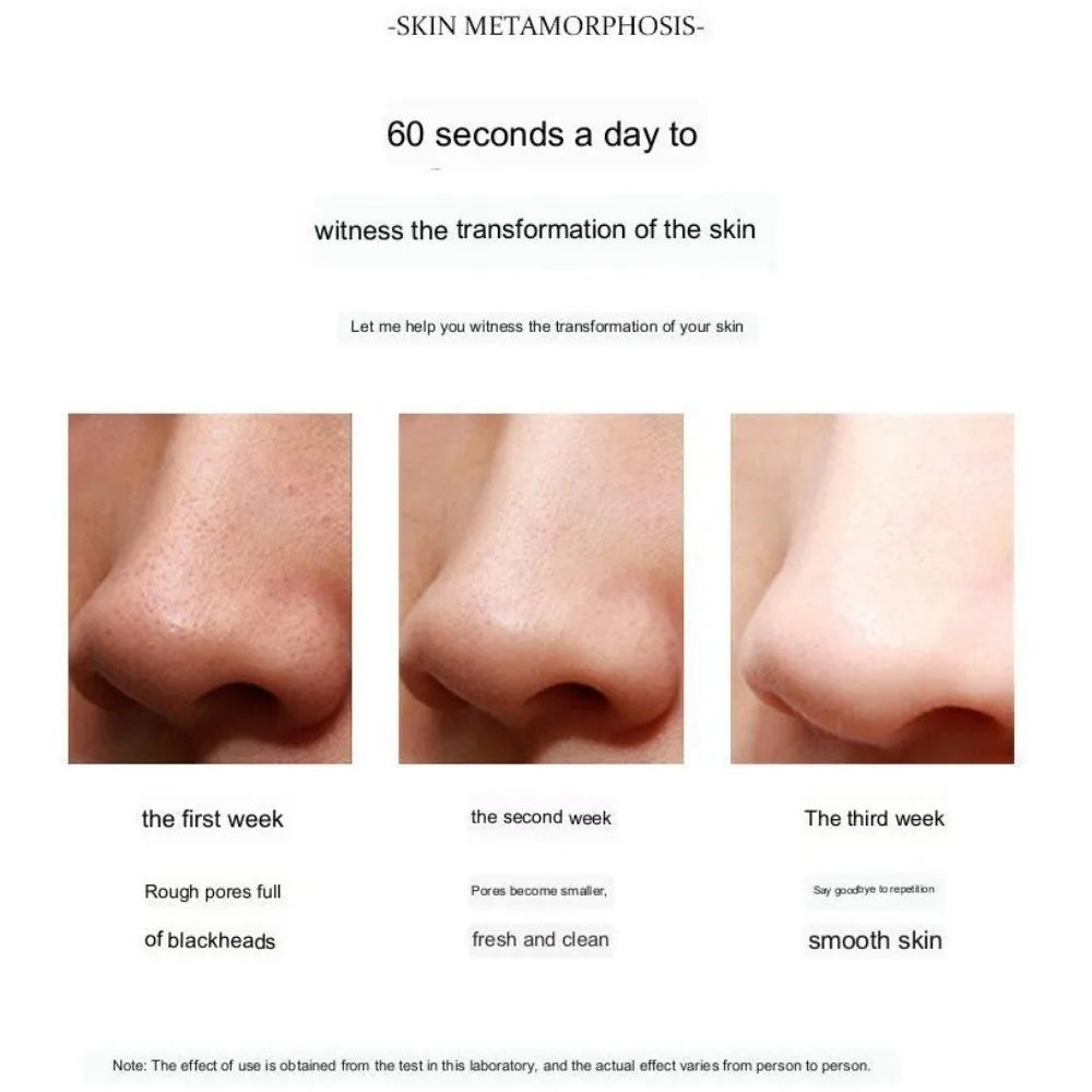 Visual Blackhead Pore Cleaner