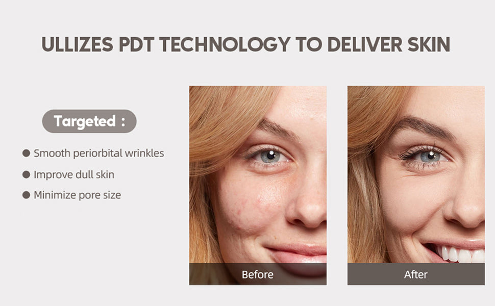 Electric Facial Mask Device